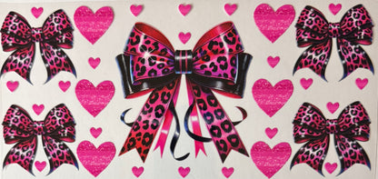 Bows